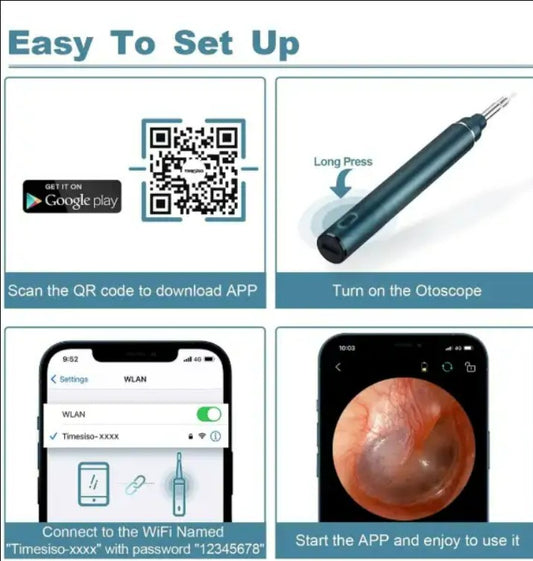 Earwax Remover with Camera